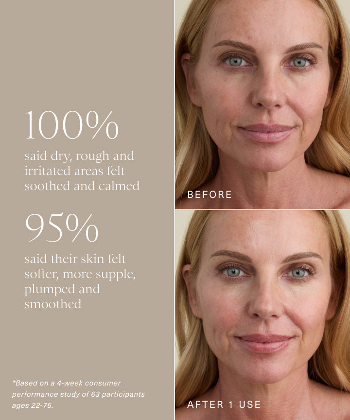 Moisture Rich Emulsion