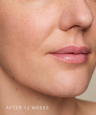 Consumer results image