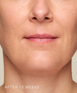 Consumer results image
