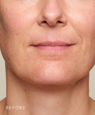Consumer results image