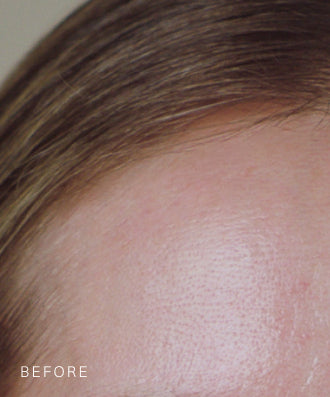 Consumer results image
