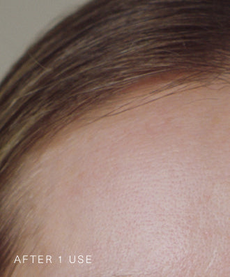 Consumer results image